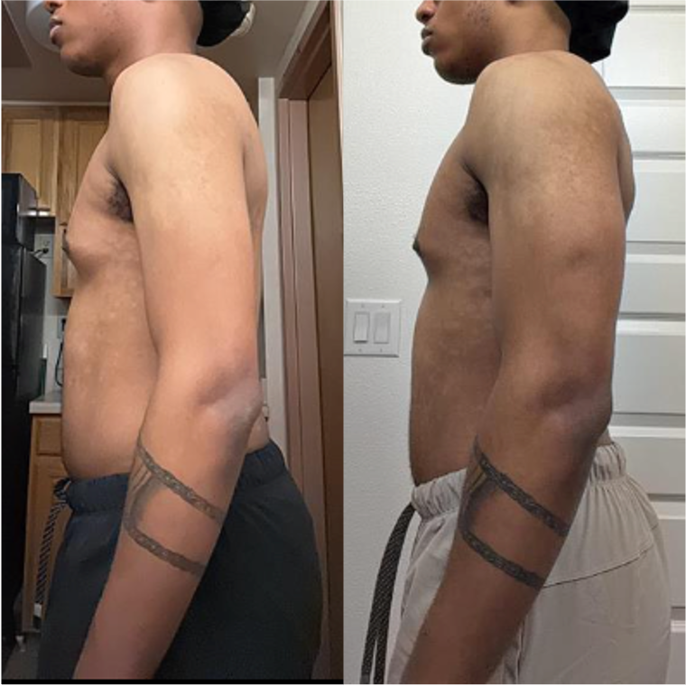 Side-by-side comparison of a shirtless man, showing a noticeable change in body composition, with the left image depicting a slightly larger belly and the right image showing a slimmer physique.