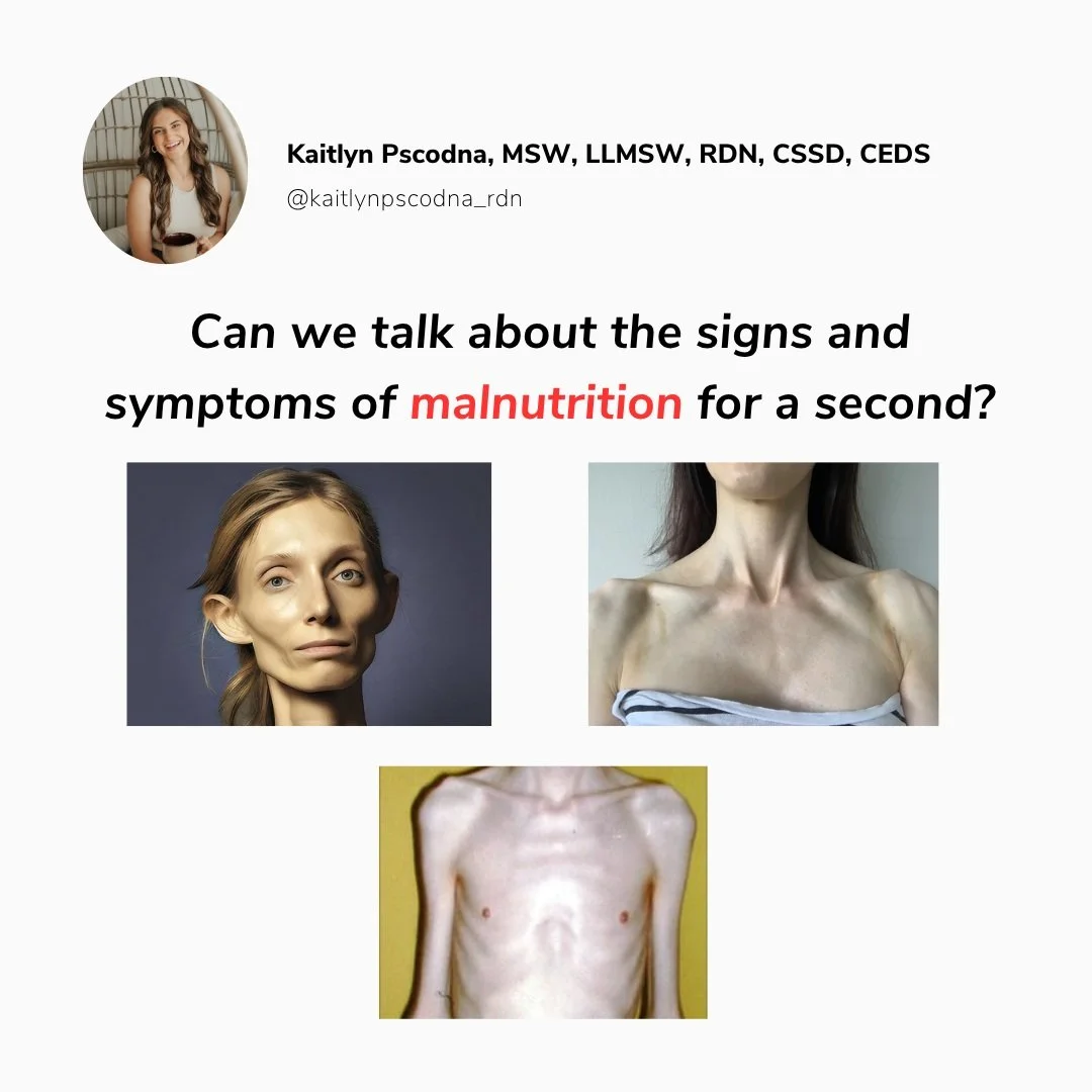 We need to talk about what we're praising as "fitness."

The photos in this post are textbook signs of malnutrition, the kind we're trained to recognize in dietetics school. Hollowed temples. Sunken orbital fat pads. Protruding collarbones.