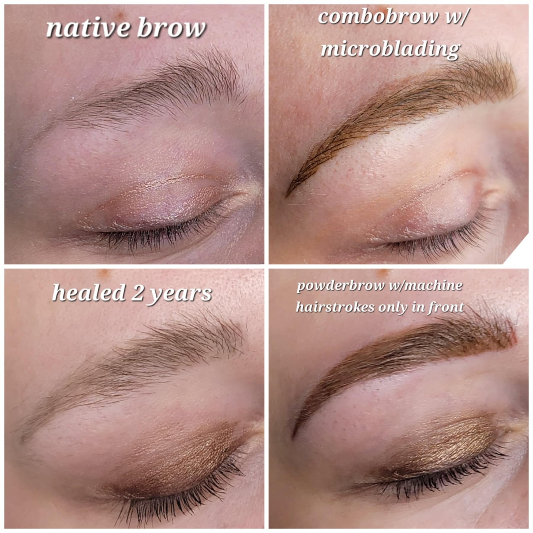 healed-brows-two-years.jpg