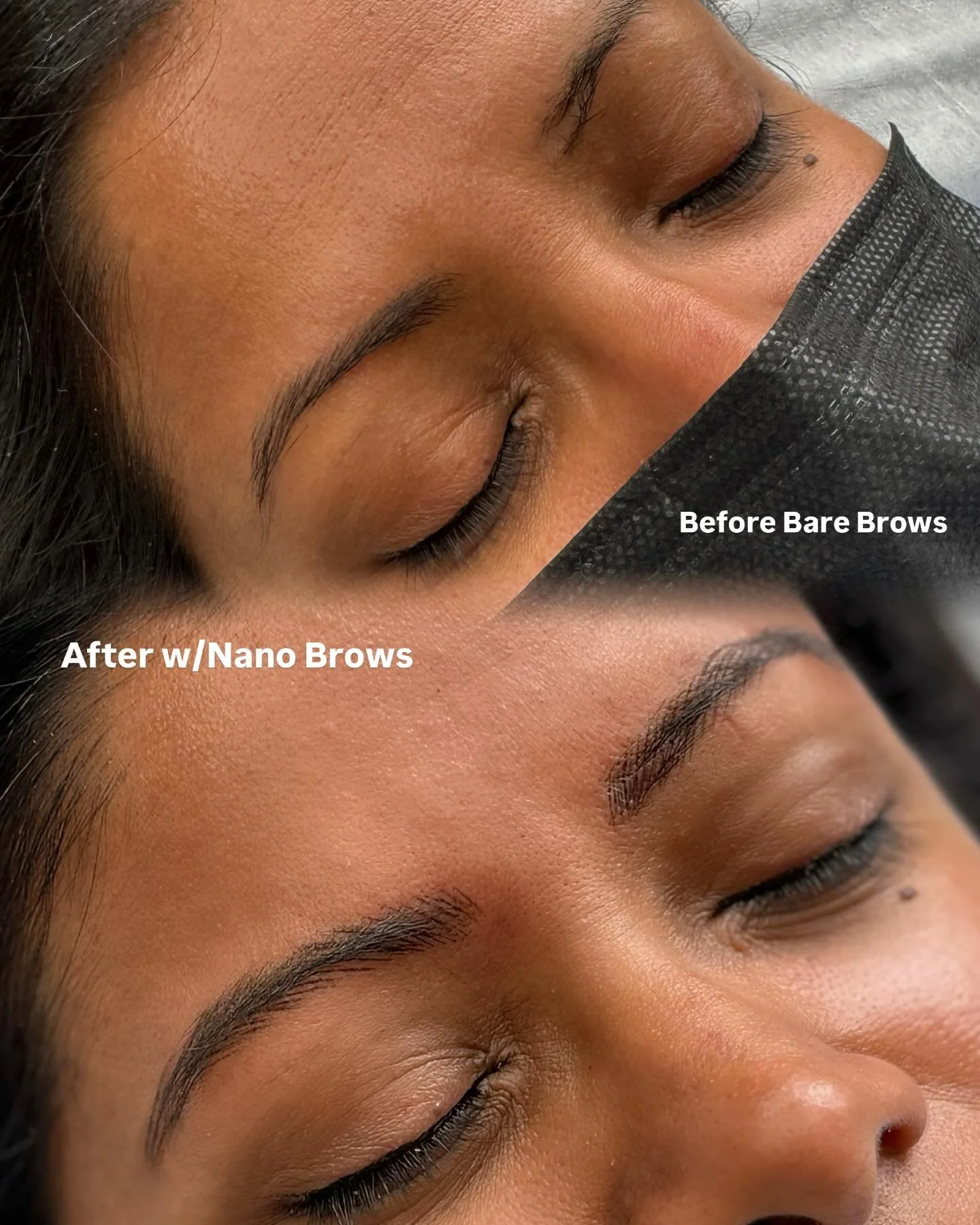 Cover a lifelong scar + get fluffy brows all at once? That&rsquo;s the power of Nano Brows 😏

#nanobrows #myabeaustudio #torontonanobrows #markhambrows #markhambrowsartist #torontonanobrows #torontobrowartist