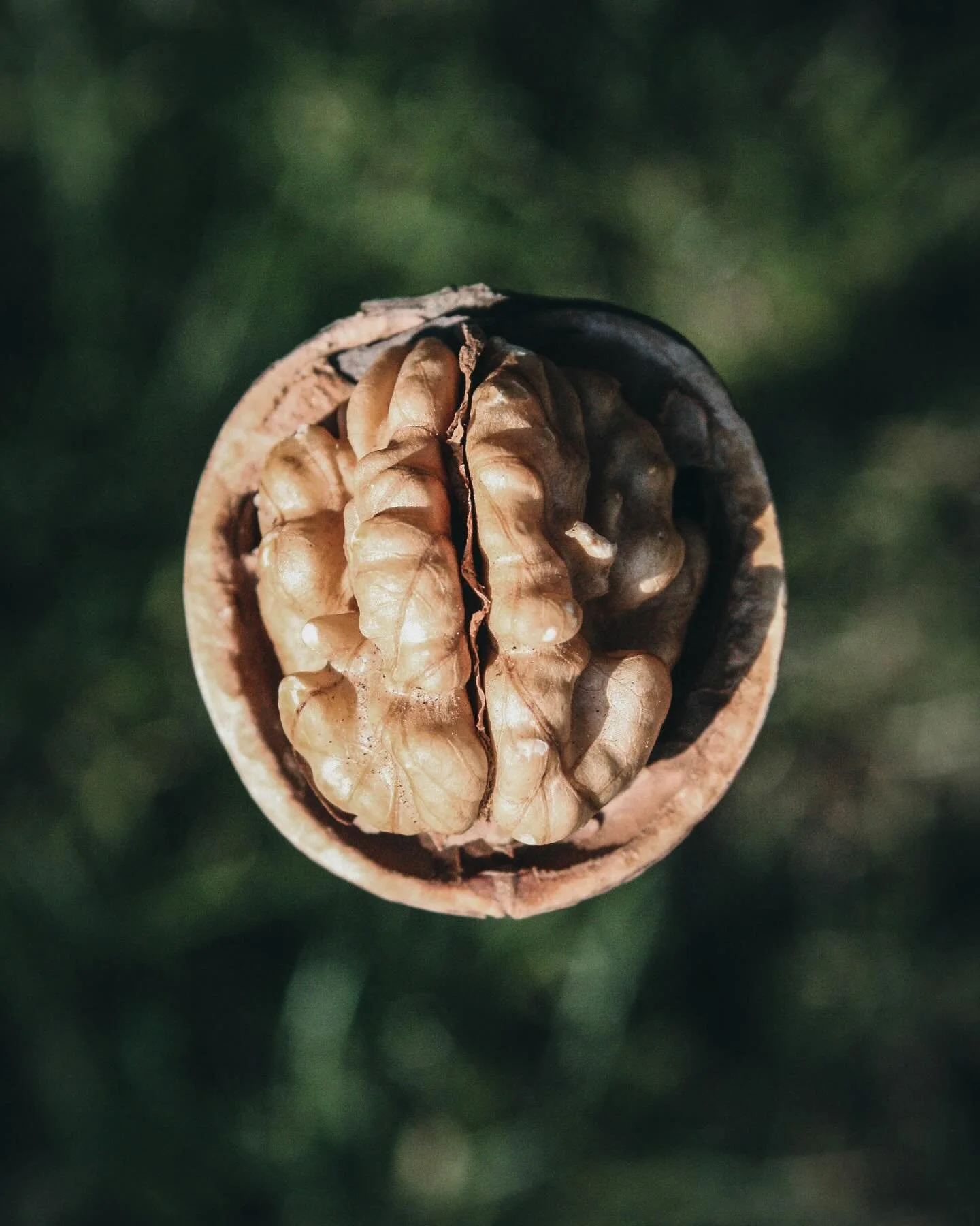 Lifetime risk of dementia from age 55 to 95 is estimated at 42%, with risk increasing significantly after 75 years of age. 

42%

Some population have risks as high as 59%. The good news? With advanced testing and history we can estimate your risk of
