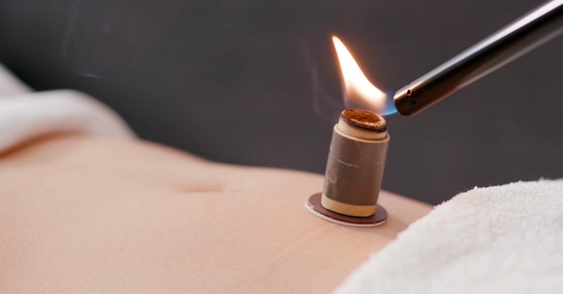 An image of moxa being applied to the lower abdomen a technique often used at Louisville Family Acupuncture to deliver infrared heat to ease complex pain and other various conditions.