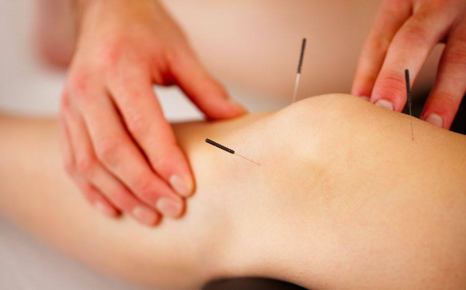 Gentle and effective acupuncture applied to a persons knee targeting chronic pain and promoting health and relief.