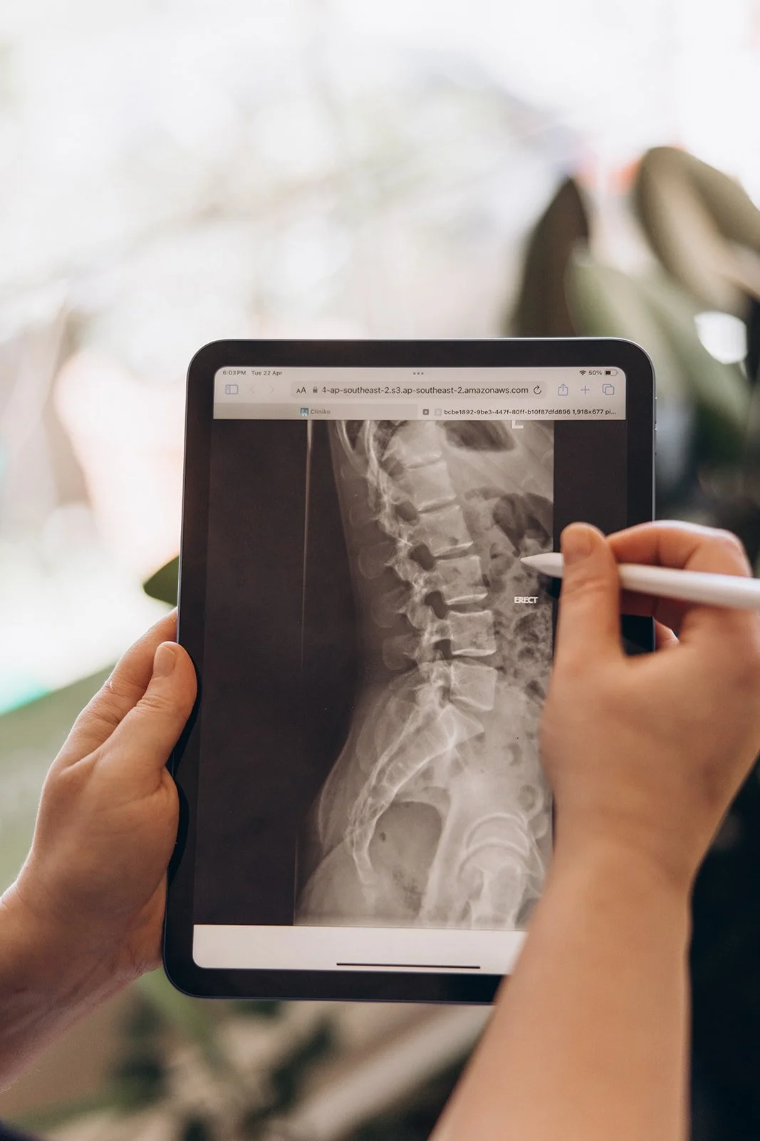 Could Your Neck Pain Be Causing Your IBS? The Gut-Spine Connection Every Mum Should Know