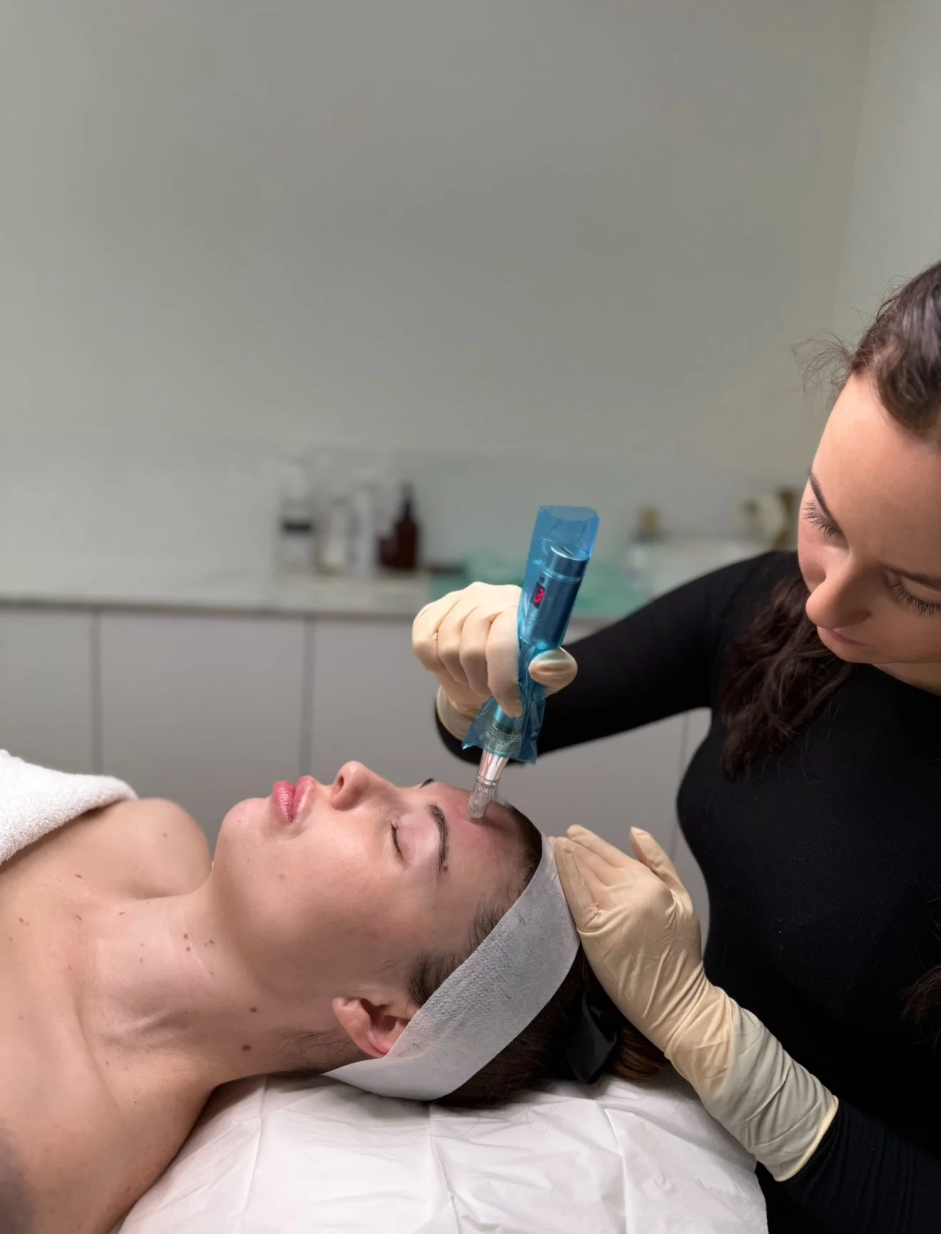 Woman receiving skin needling treatment from a skincare therapist wearing gloves