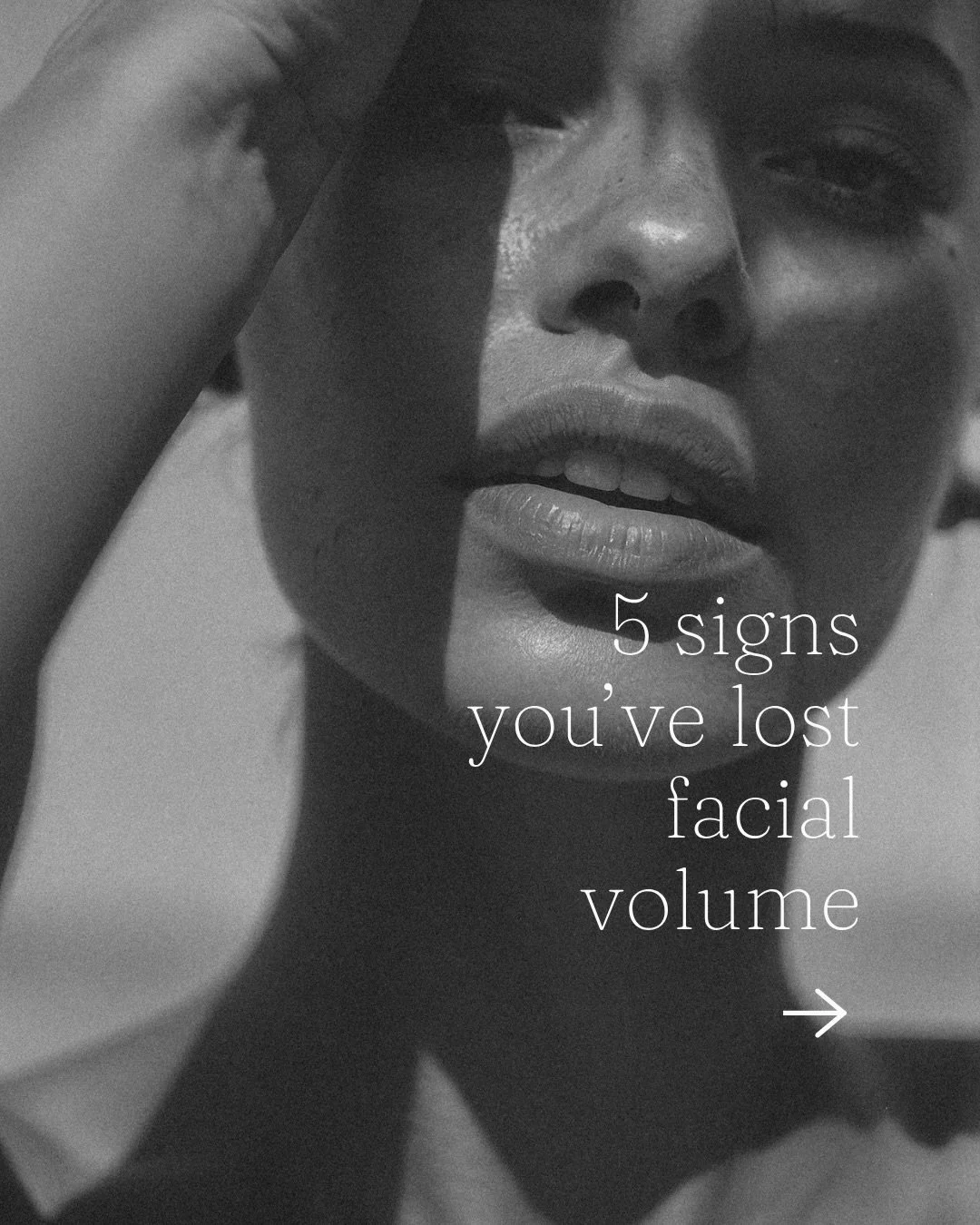 You&rsquo;re not imagining it.

Your face DOES change in your mid 30&rsquo;s, 40&rsquo;s and 50&rsquo;s. Volume shifts. Structure softens. Things sit a little differently than they used to.

And it&rsquo;s not about looking younger. It&rsquo;s about 