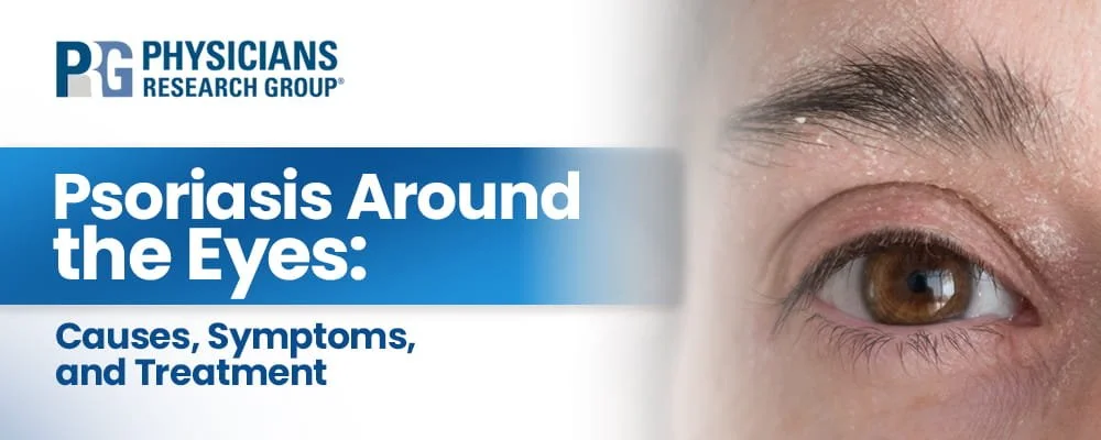 Psoriasis around the Eyes Causes Symptoms and Treatment