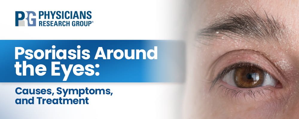 Psoriasis Around the Eyes: Causes, Symptoms, and Treatment