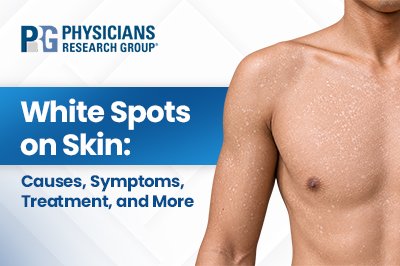 White Spots on Skin: Causes, Symptoms, Treatment, and More