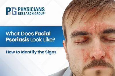 What Does Facial Psoriasis Look Like? How to Identify the Signs