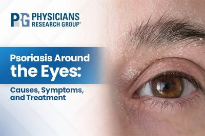 Psoriasis Around the Eyes: Causes, Symptoms, and Treatment