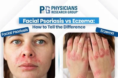 Facial Psoriasis vs Eczema: How to Tell the Difference