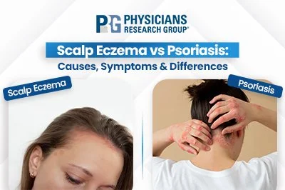 Scalp Eczema vs Psoriasis: Symptoms, Causes, and Treatment Differences