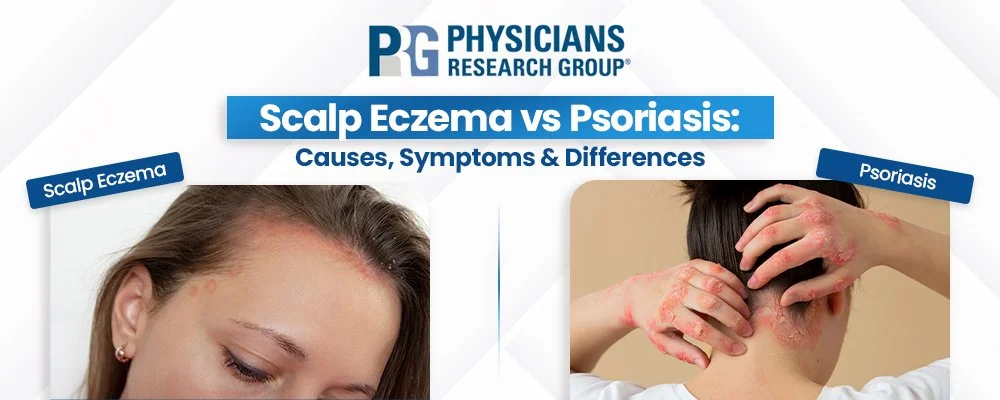 Scalp Eczema vs Psoriasis: Symptoms, Causes and Treatment