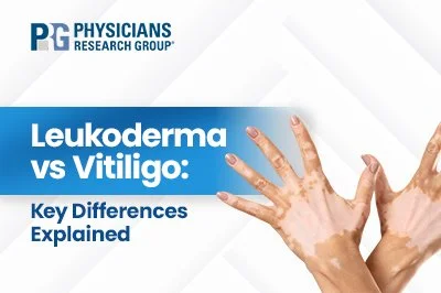 Leukoderma vs Vitiligo: Key Differences Explained