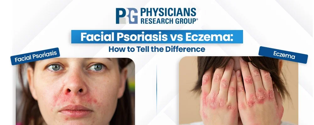 Facial Psoriasis vs Eczema: How to Tell the Difference