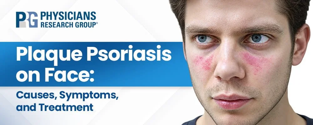 how to treat psoriasis on face