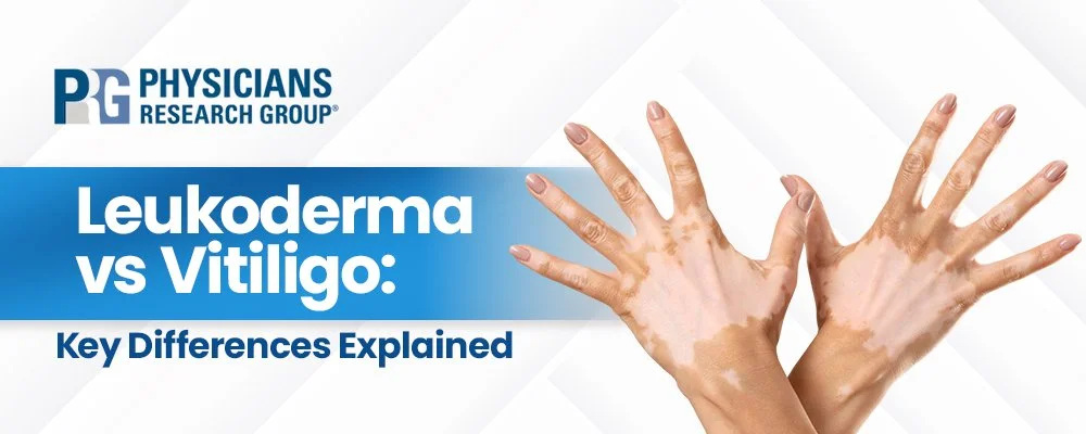 Leukoderma vs Vitiligo: Key Differences Explained