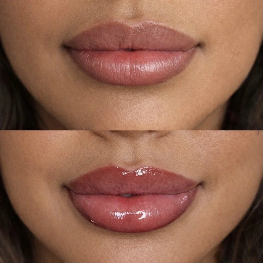 Close-up of a woman's lips in two images, top with natural lips and bottom with glossy lip gloss applied.