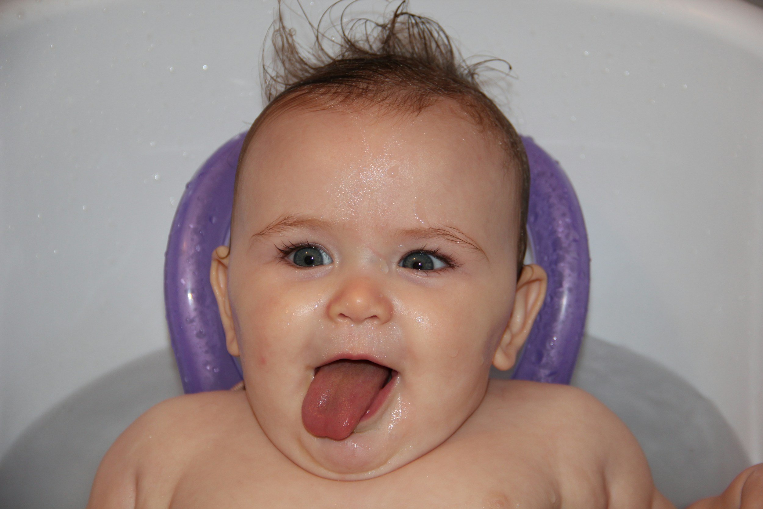 What You Need to Know About Tongue-Tie Releases for Infants