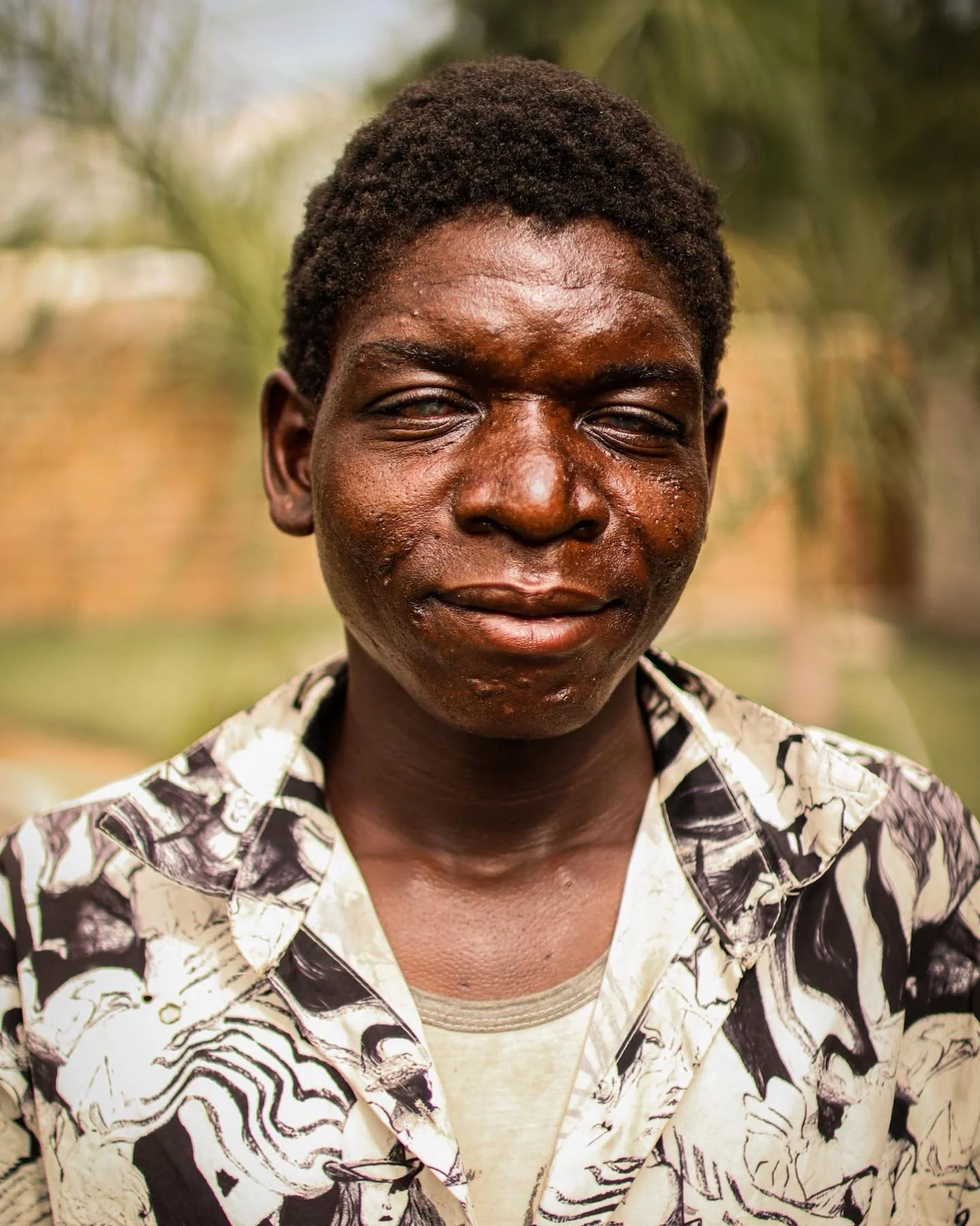 MICHELO.

This is Michelo. He&rsquo;s a gentle, soft spoken young man in his early 20s. He was born with HIV, and has lived with it all his life. Over the last decade, his eyesight began to deteriorate as a result, to the point he could no longer go 