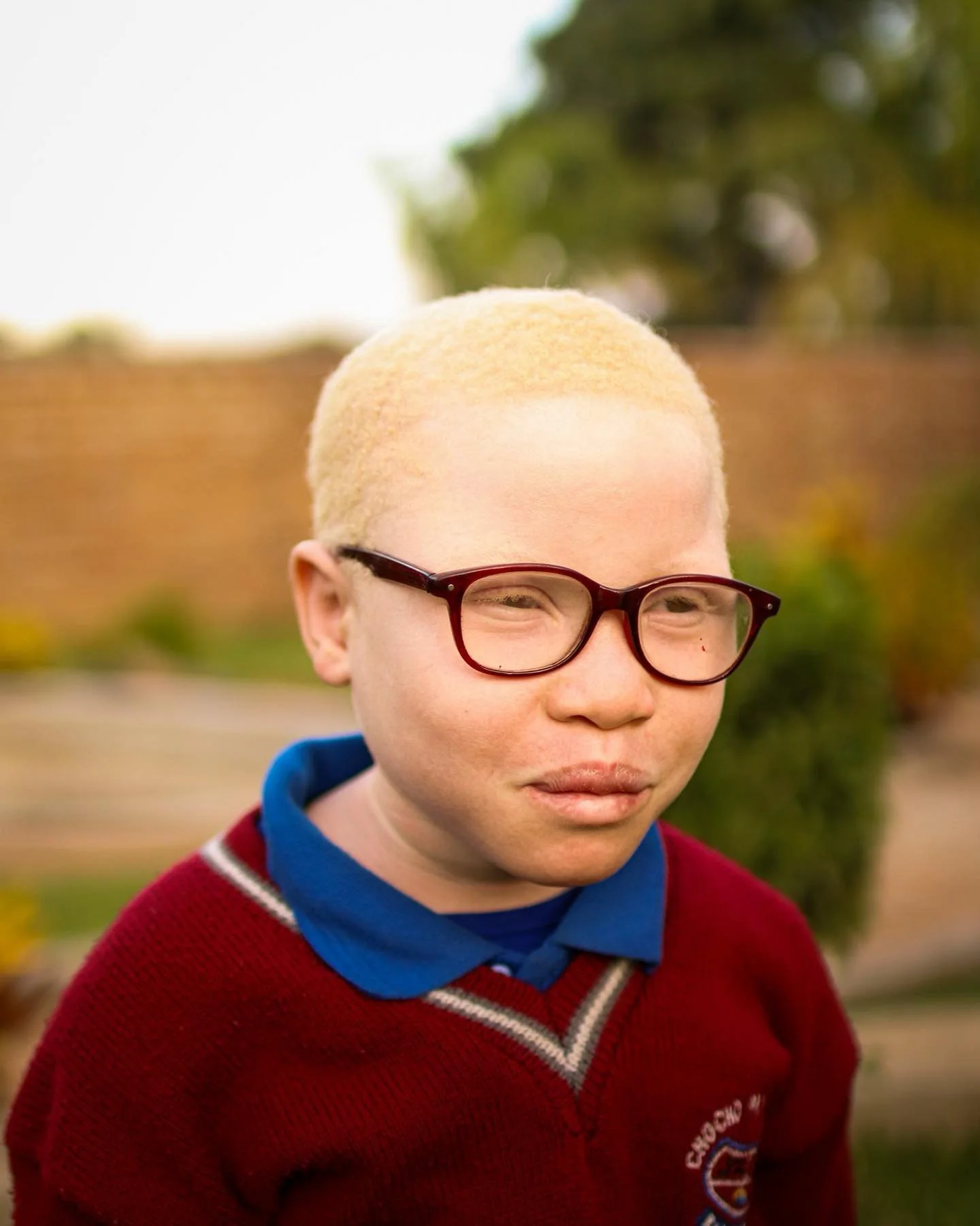 THIS IS MALVINAH. MIRACLE GIRL.

Some time ago, there was a knock on our door at Overflow, where a young mother and two daughters stood. The daughters both had albinism, which in Africa is a bit more prevalent for several reasons.

They came searchin