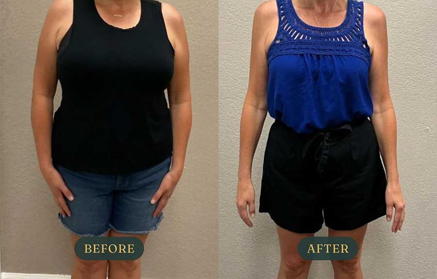 weight-loss-in-redding-1.jpg