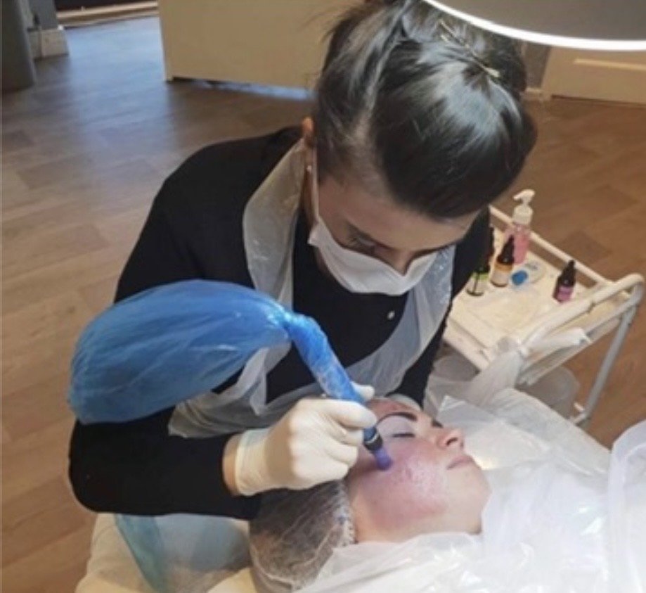 Micro Skin Needling - Collagen Induction Therapy