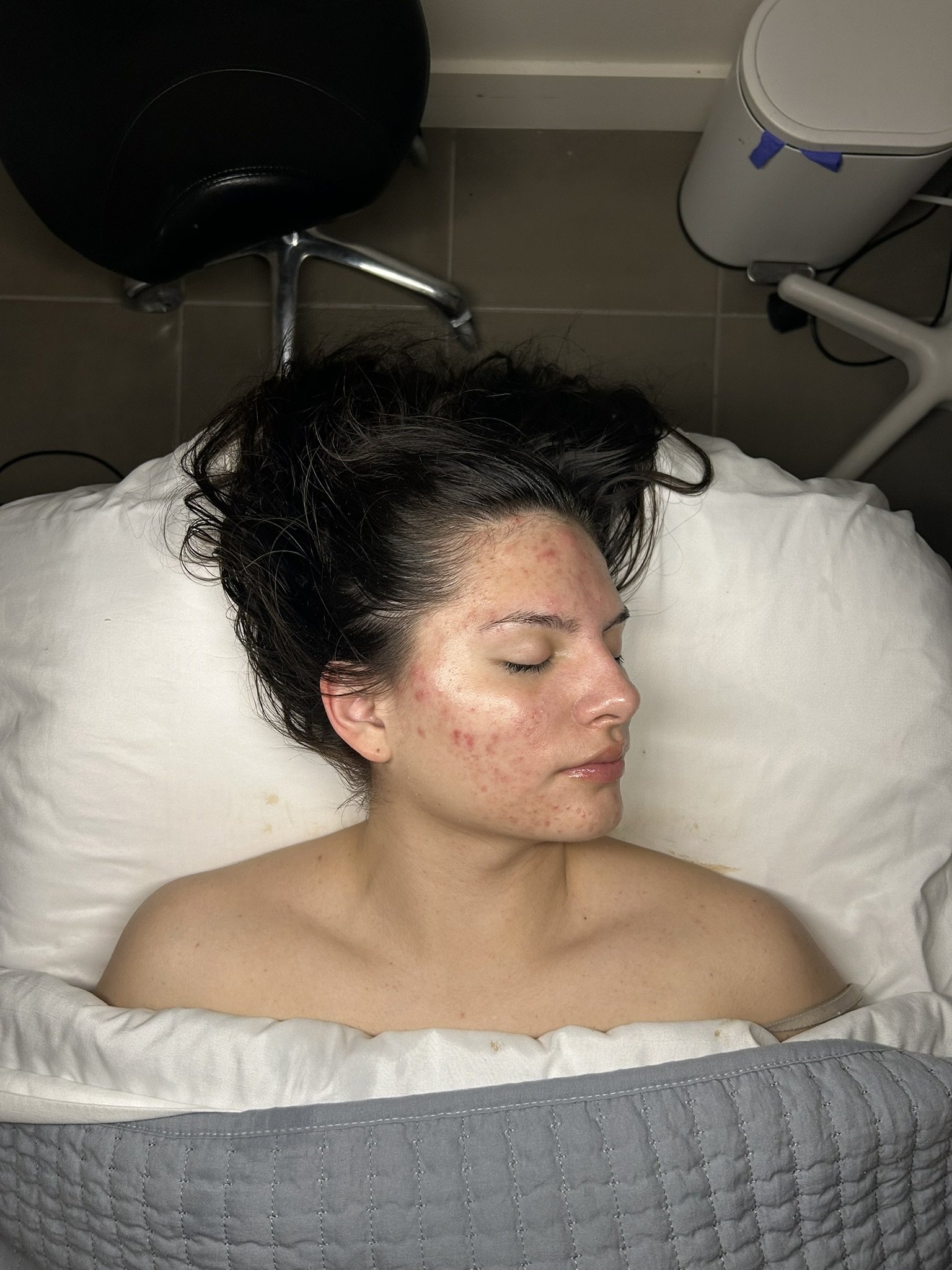 Client after an Oxygen Rx facial at Skin Theory Studio