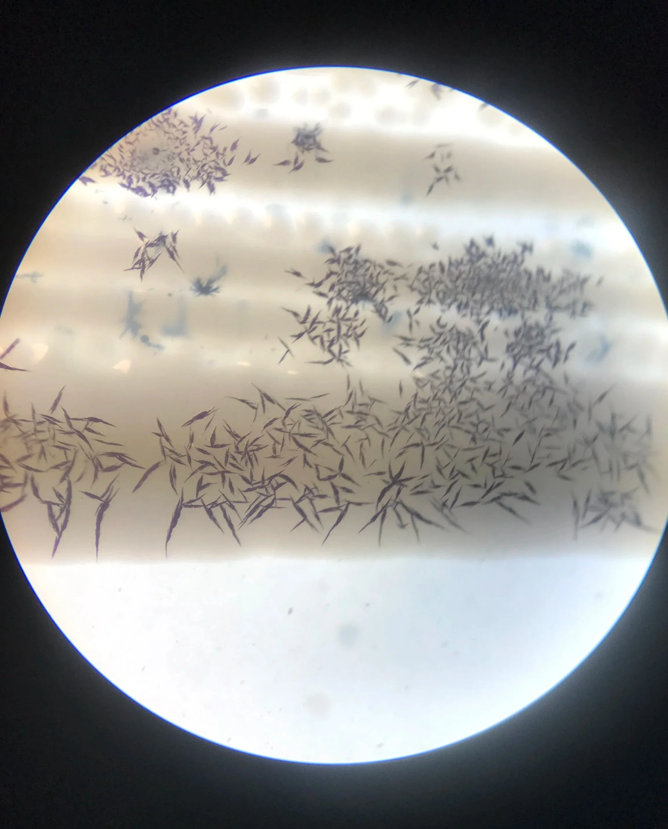 Crystals+in+streak+of+Brevibacterium.jpg
