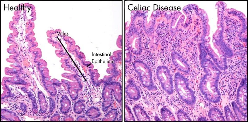 A Note from Miguel: Papo secos are not celiac approved