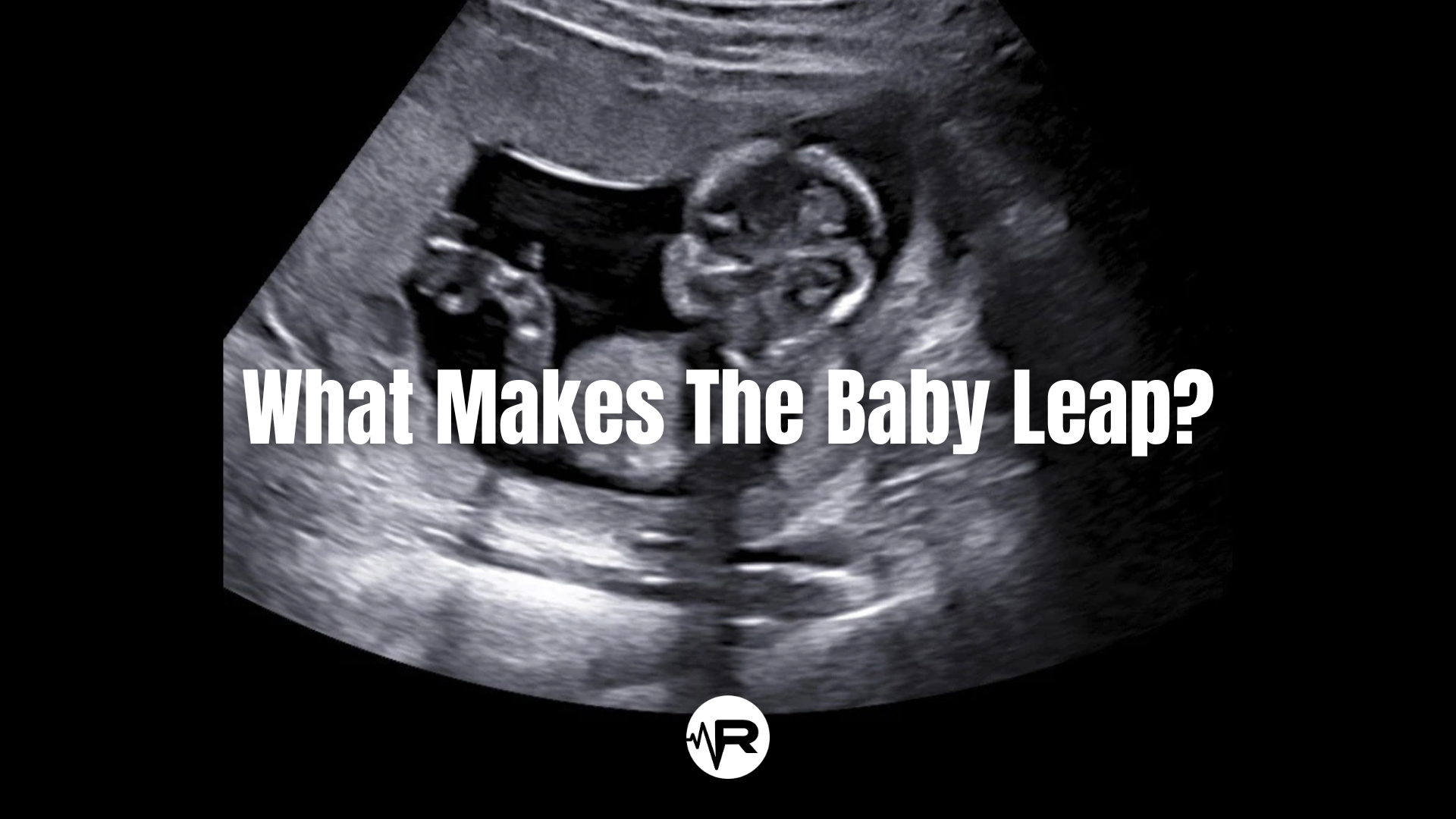What Makes The Baby Leap?