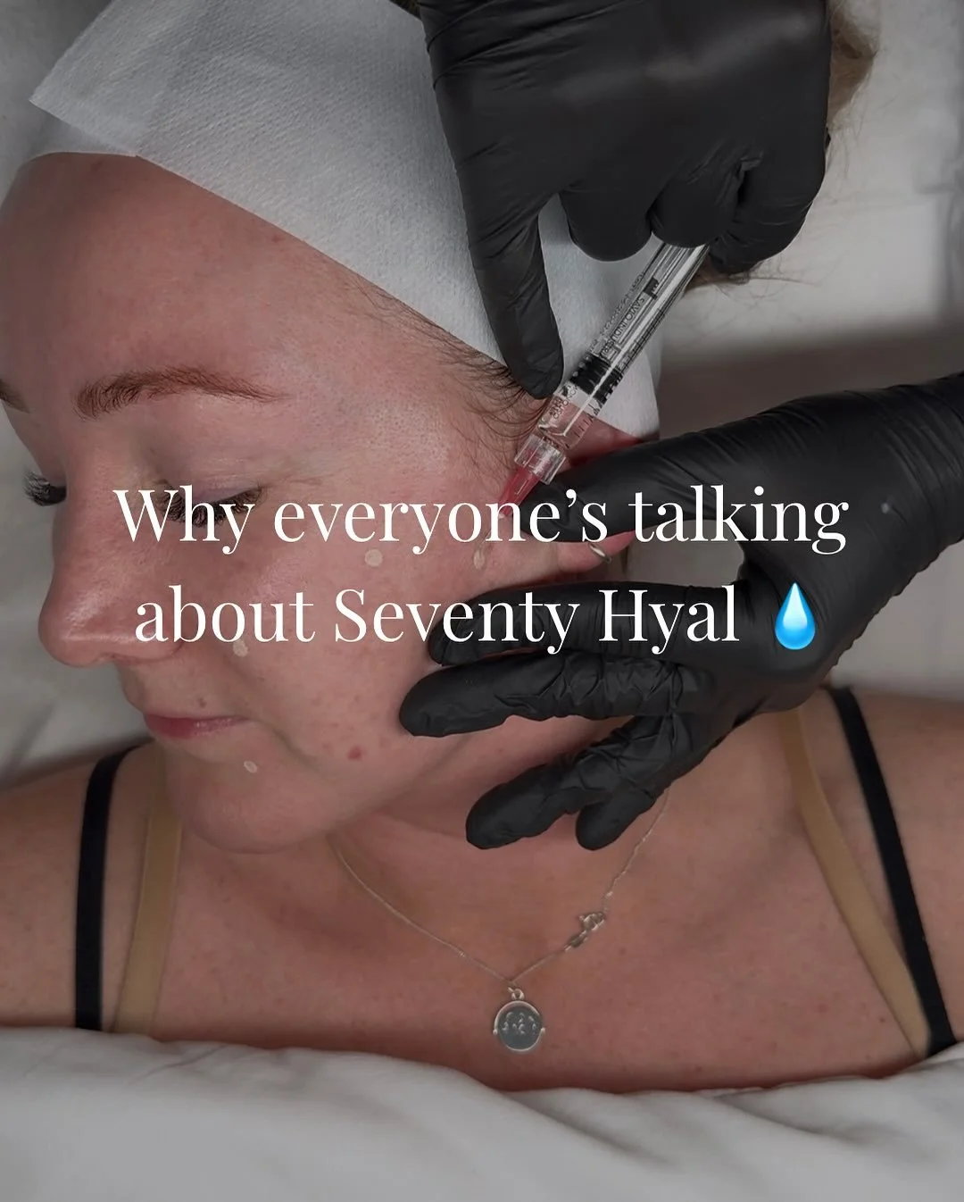 Hydration you can&rsquo;t get from skincare alone 💧

Seventy Hyal delivers a surge of moisture, improves texture, and restores that natural plumpness we lose with age.

Perfect for dull, tired, dehydrated skin and a must before autumn to keep skin l