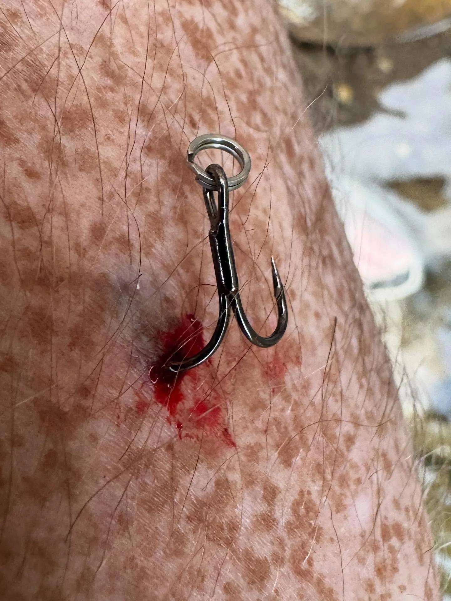 Don’t let the freckled cheetah print fool you. This stock treble hook was buried past the barb.
Barbs matter.
When I stick a hook in my skin past the barb, I want to be in a damn pickle. I want to morph into Jeremiah Johnson, MacGyver, and Hu