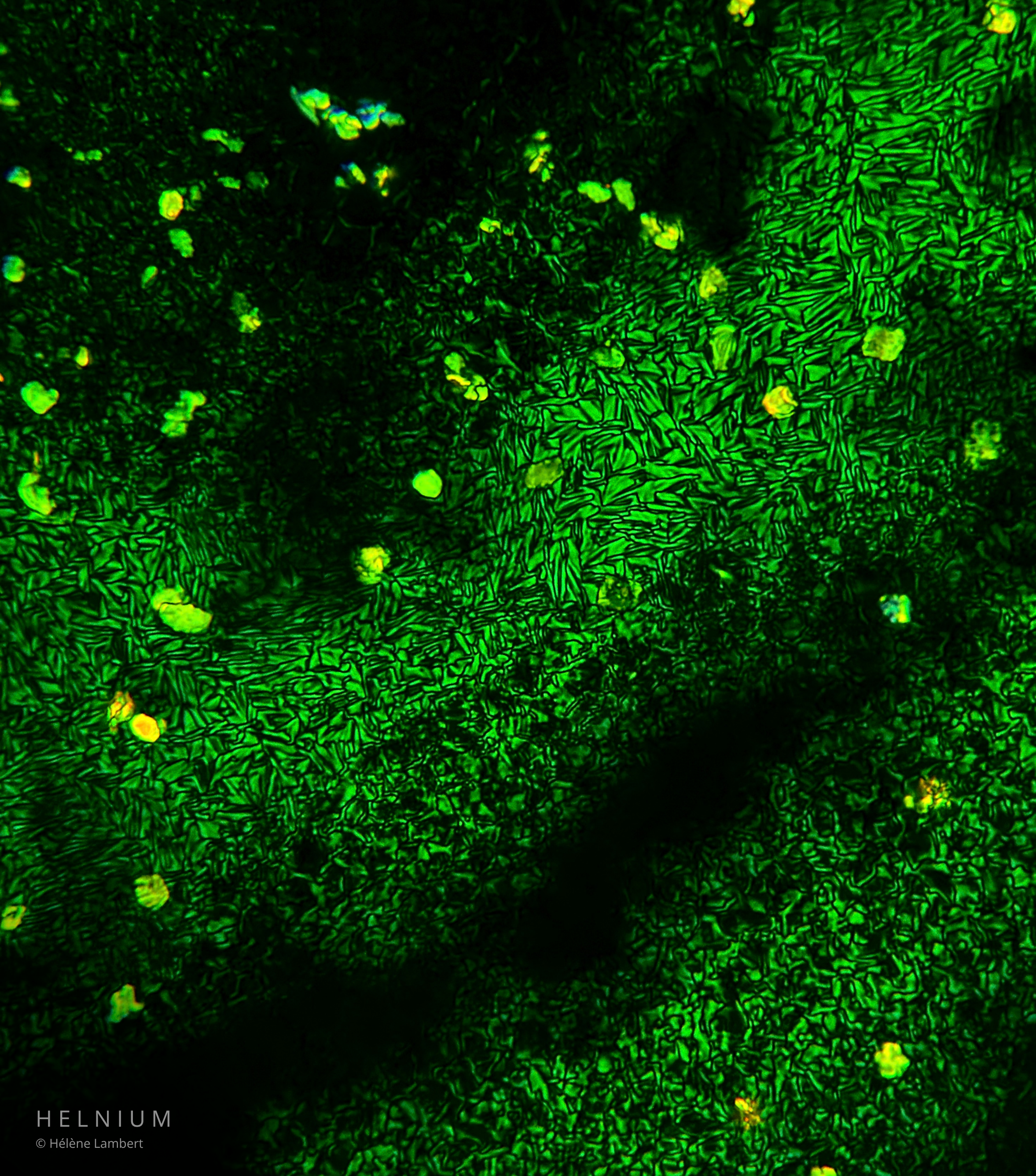Photosynthetic pigments extracted from spinach leaves, chlorophyll microscopy and pigment crystallization, second scientific image from Helnium.