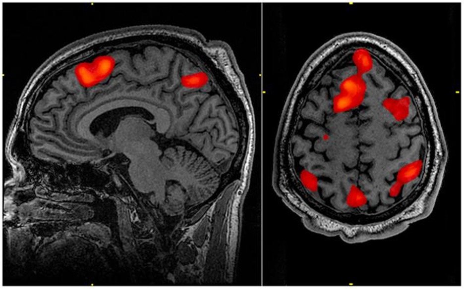 The Intersection of Eating and Memory Consolidation