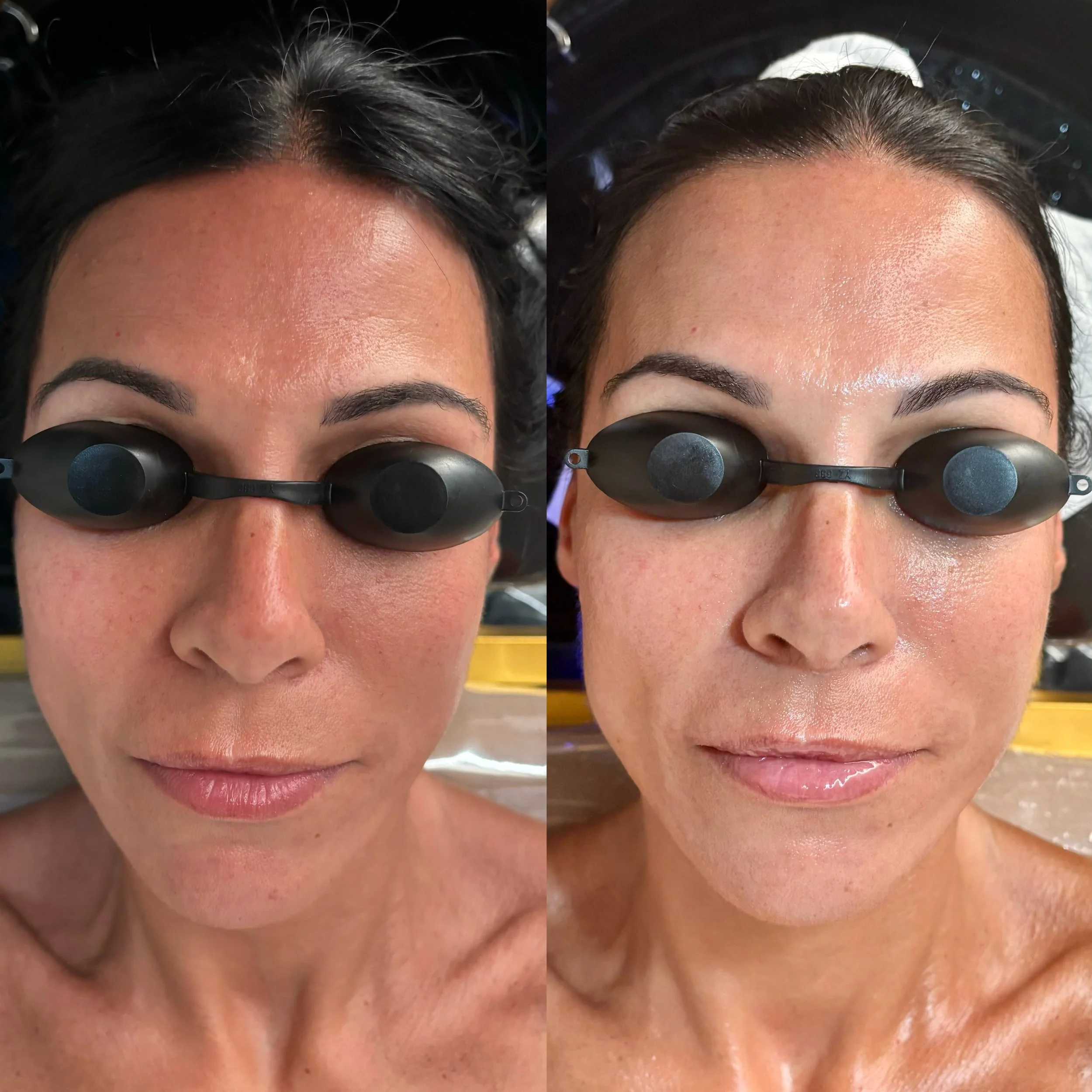 Bright_&_Glow_Peel_Facial