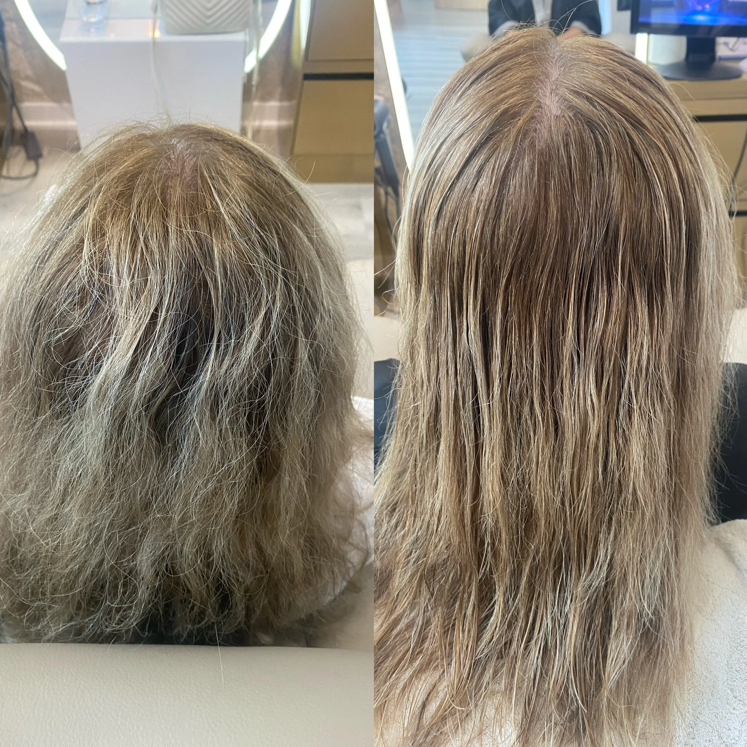 Before after Repair & Anti-Sensitivity treatment