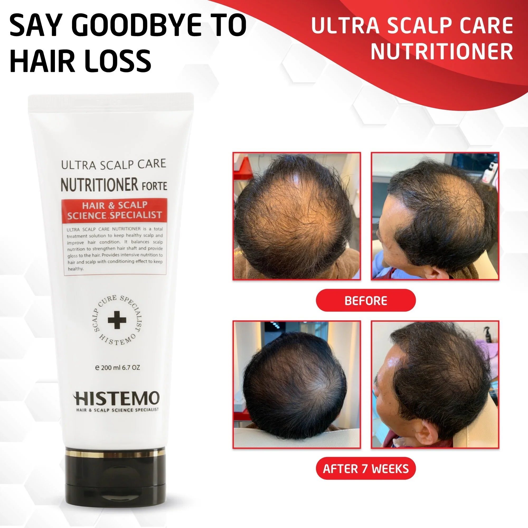 Histemo-Nutritioner-San-Spa-Chicago5.webp