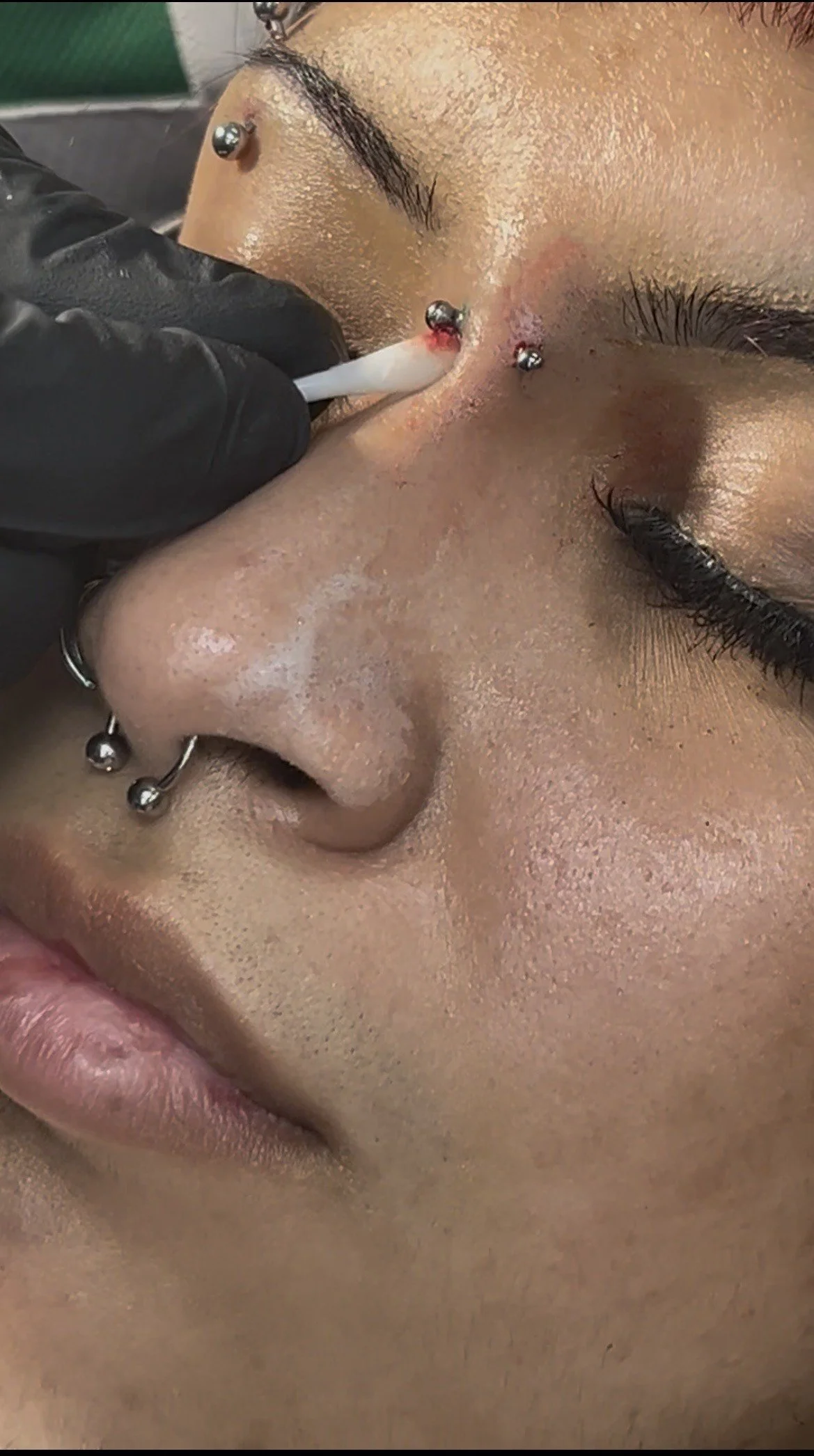 A person receiving a nose piercing with a needle, with multiple facial piercings visible including a septum piercing and a nostril piercing, close-up of a face with closed eyes.