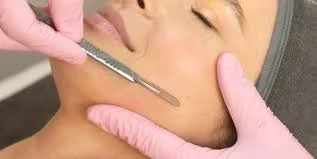 Close-up of a woman receiving a cosmetic facial procedure using a small surgical tool by a professional wearing pink gloves.