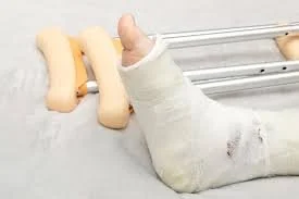 Modern Ankle Fracture Treatment in Melbourne: Surgery That Gets You Back on Your Feet Sooner