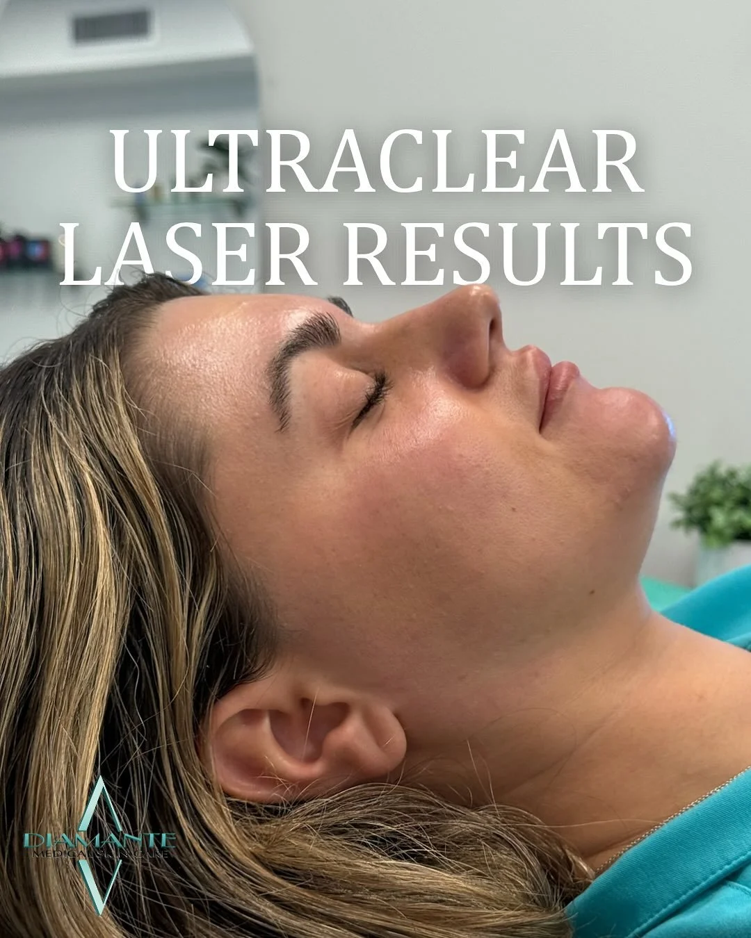 The proof is in the glow ✨ UltraClear transforms uneven skin texture, fine lines, and more giving you smooth, radiant results you&rsquo;ll love! 🌊 

If you&rsquo;re interested in this procedure, don&rsquo;t miss our Ice Party on October 9th ❄️💎 RSV