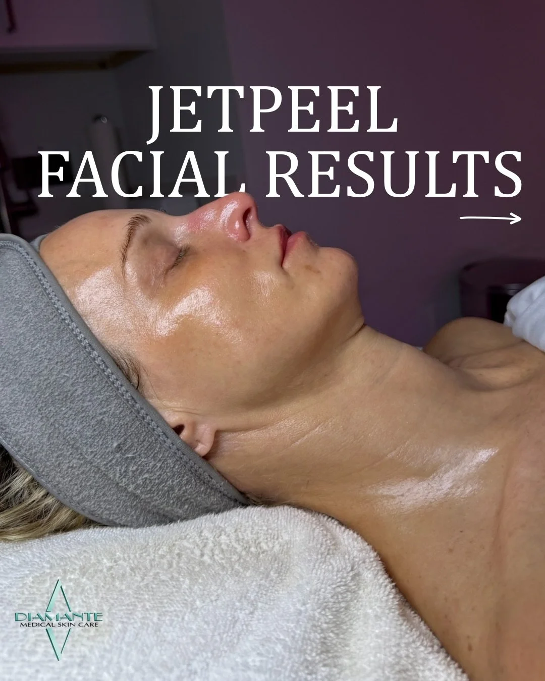 Experience next-level rejuvenation with our Jet Peel Facial! 🧖🏼&zwj;♀️ The ultimate non-invasive treatment for radiant, hydrated skin! 💧✨ This needle-free facial uses advanced jet pressure technology to exfoliate, infuse, and deeply hydrate the sk
