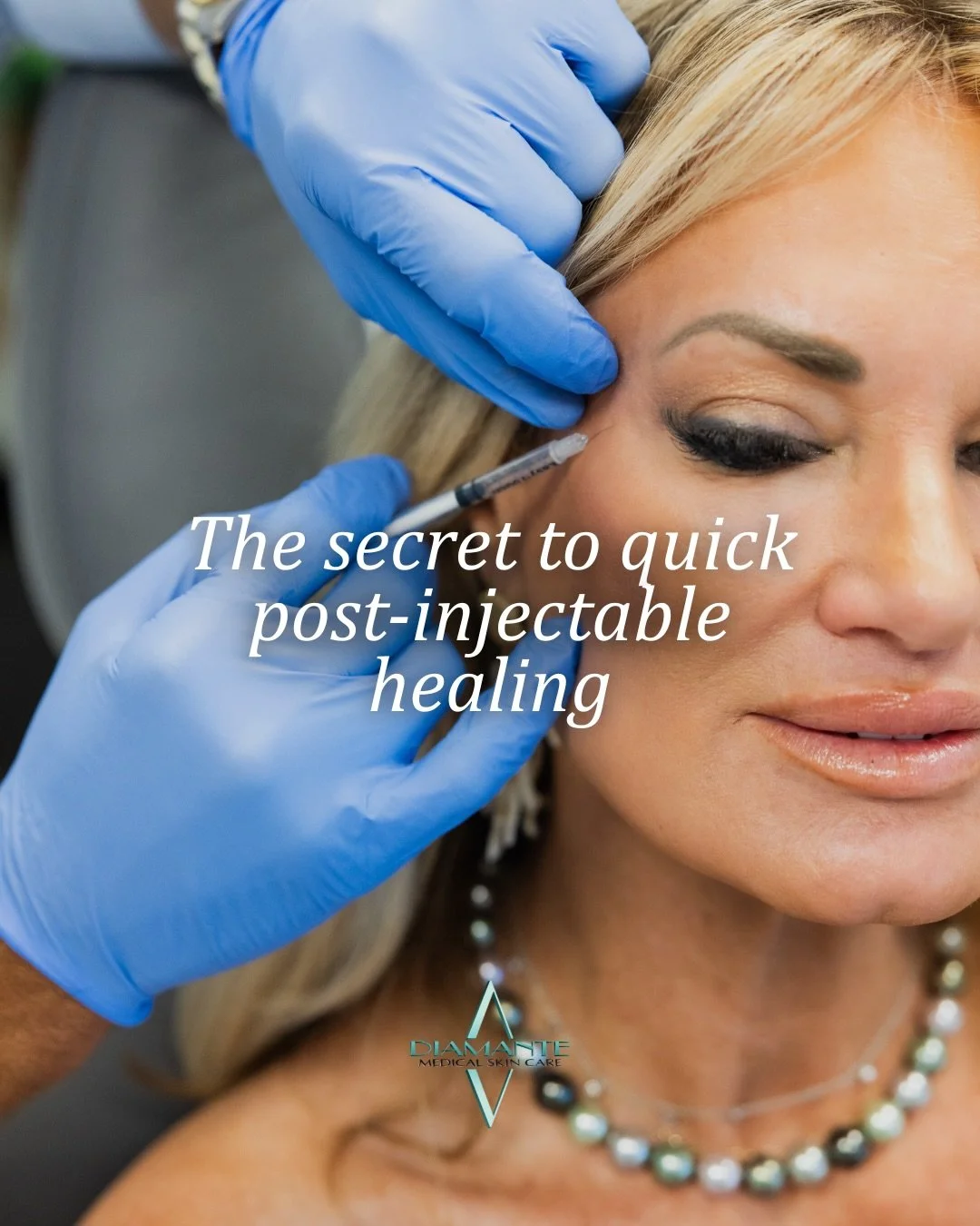 Injectables don&rsquo;t end when you leave the chair, healing plays a major role in how smooth, refined, and seamless your results look.💉

Although it doesn&rsquo;t happen often.... Swelling, bruising, inflammation are all normal. But how you suppor