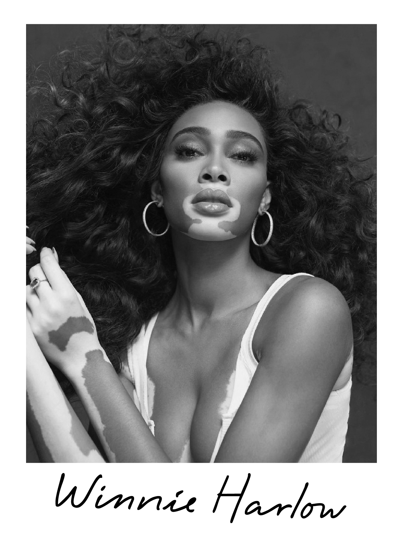 Black and white portrait of Winnie Harlow with voluminous curly hair, wearing hoop earrings, a sleeveless top, and showing vitiligo skin condition.