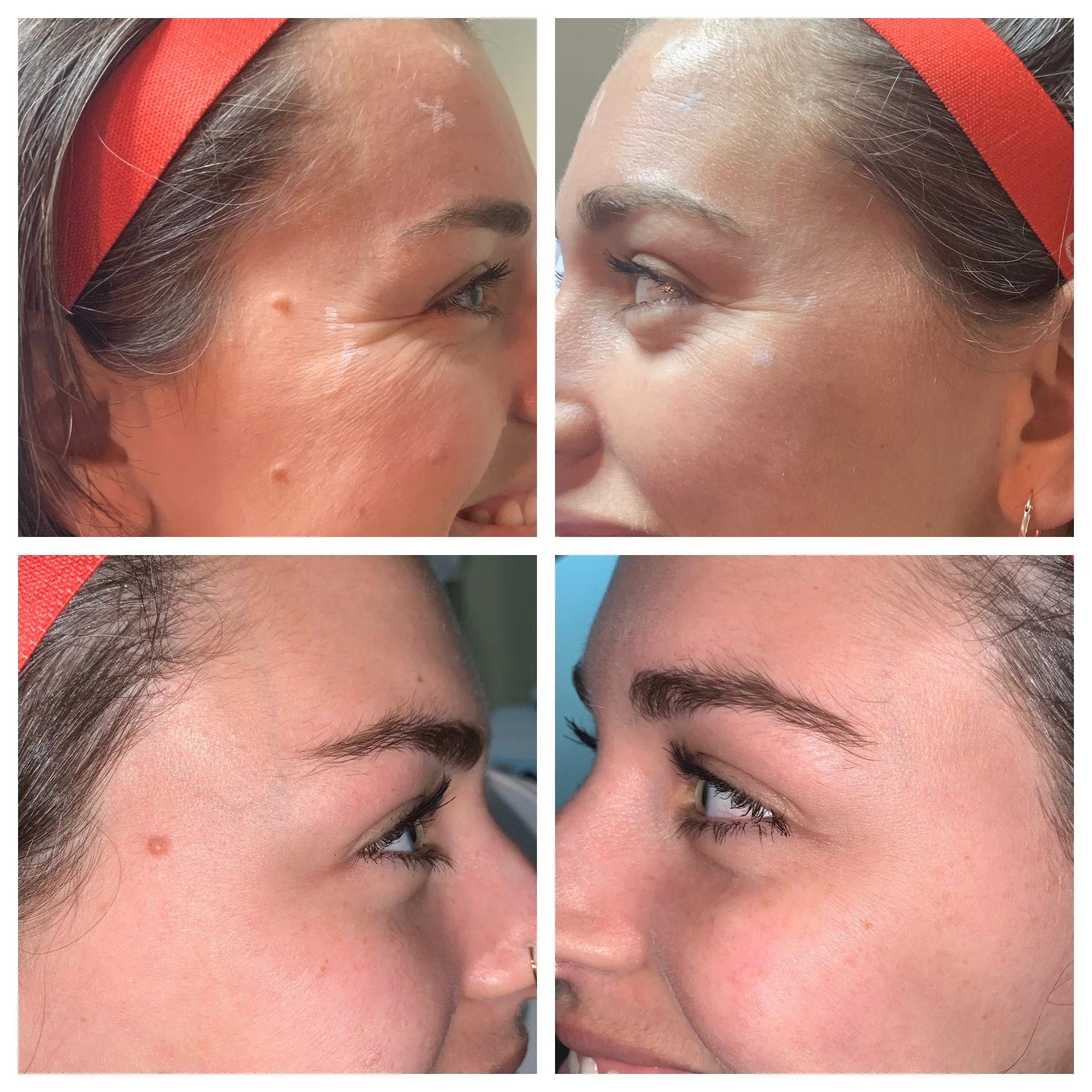 Tox b&a(1).jpg