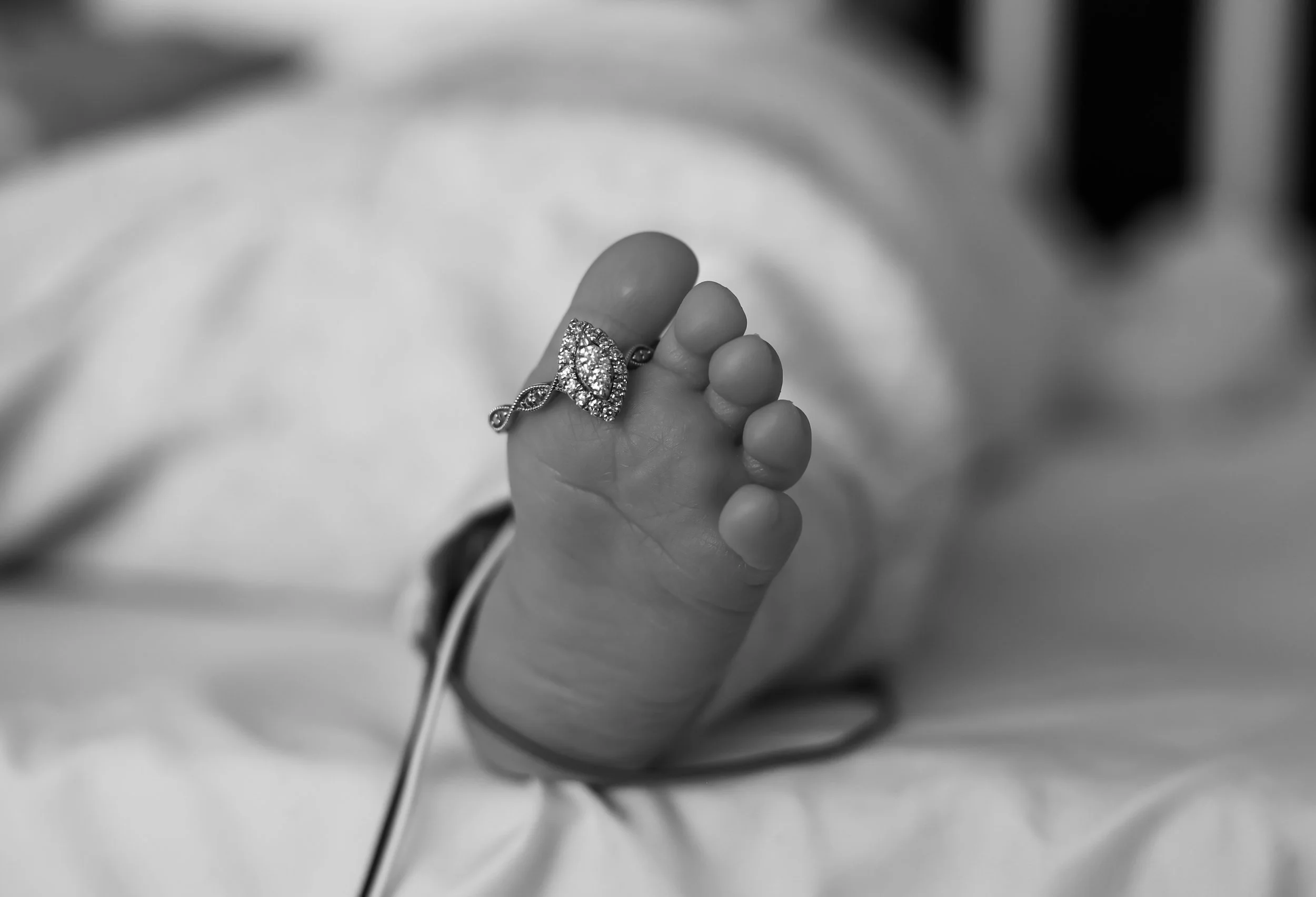 Baby Hare Twins C (5 of 8).jpg