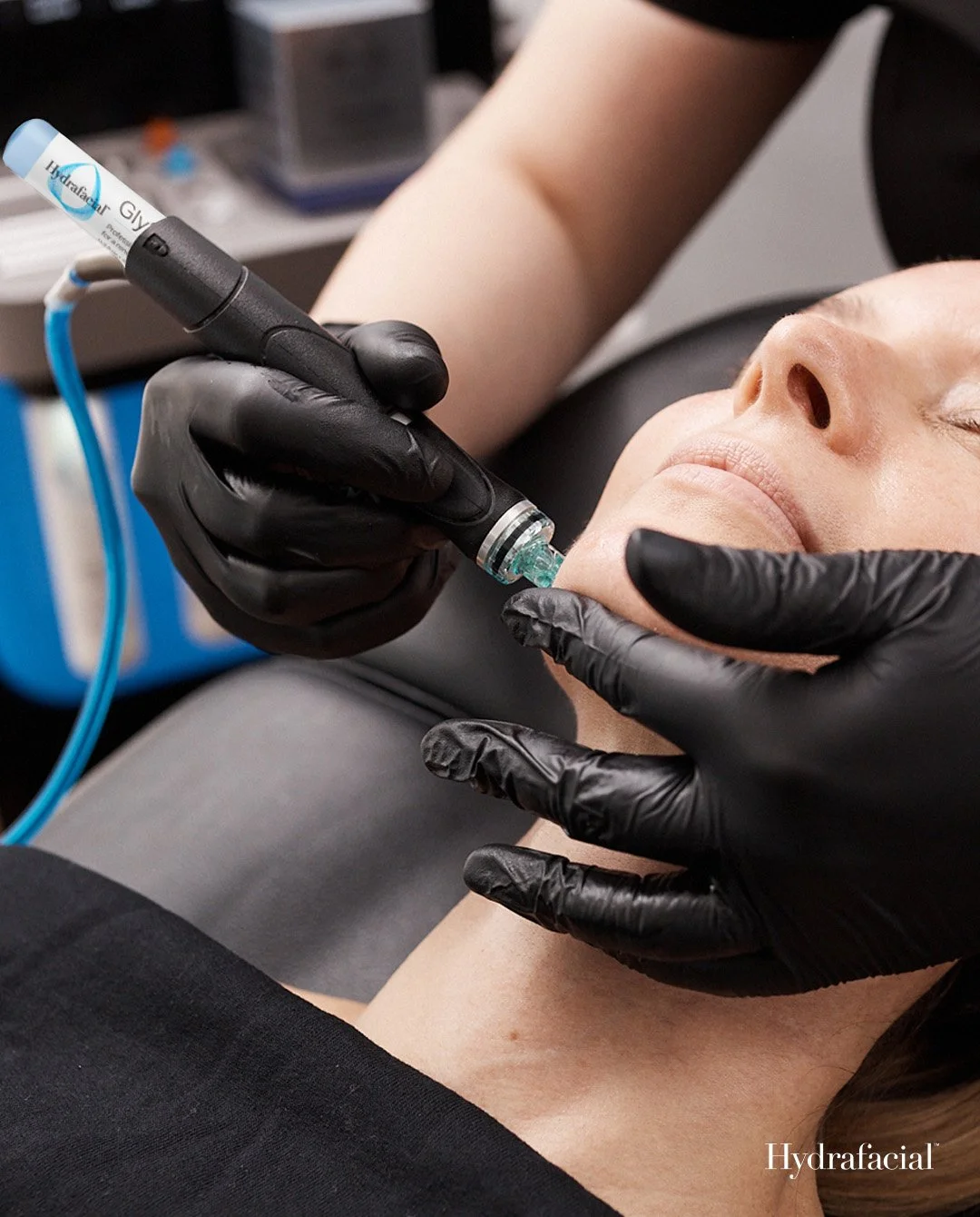 HydraFacial in San Antonio
