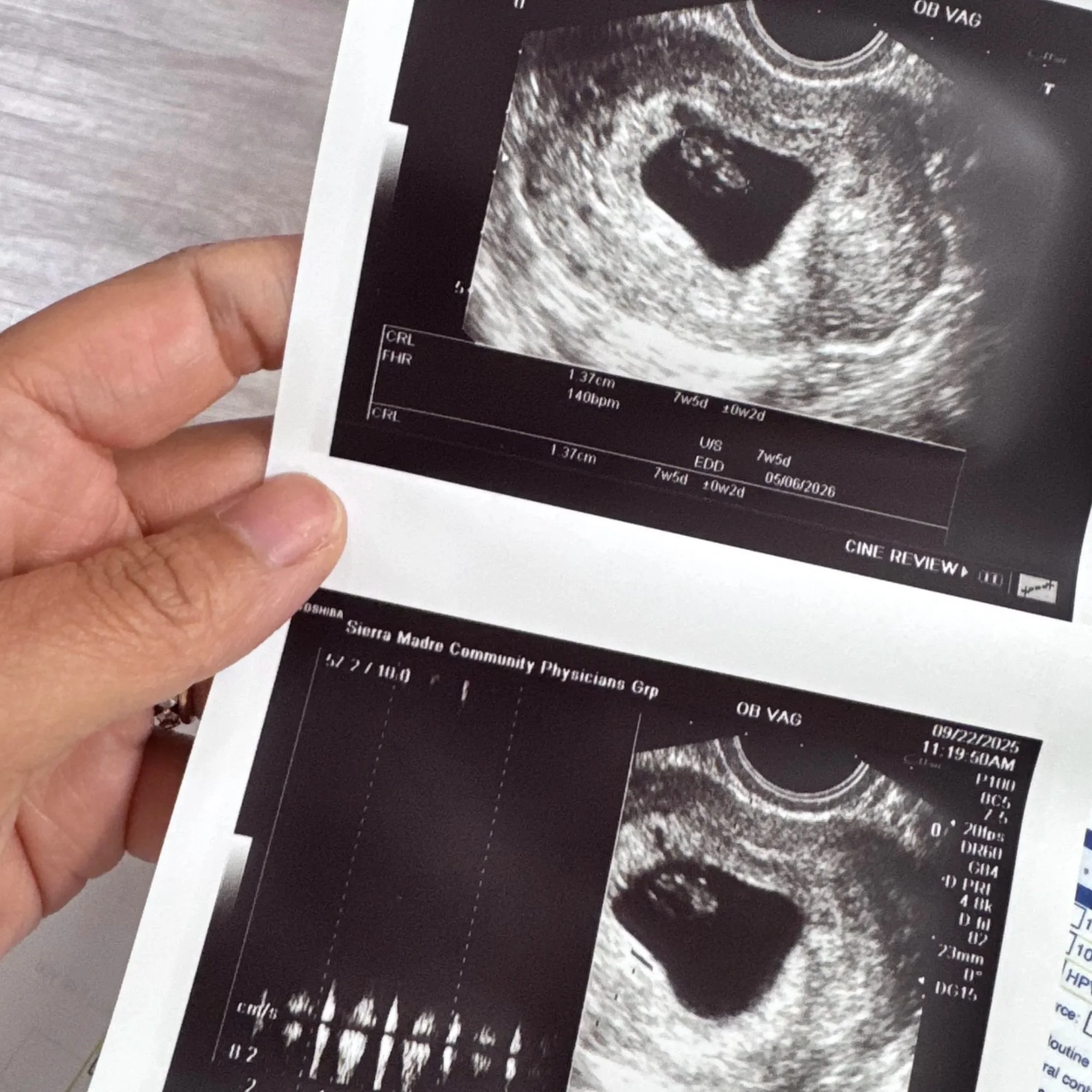 A Surprise Worth Waiting For: Why We’re Not Sharing the Gender of Baby #4